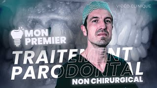 Mon Premier Traitement Parodontal NON CHIRURGICAL [upl. by Golden149]