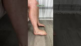 Exercises to Combat Achilles Tendonitis [upl. by Iahk935]