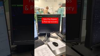 Femoral Popliteal Bypass and Post Operative recovery of the patient [upl. by Labannah843]