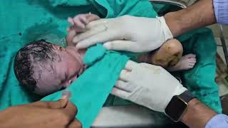 Baby not cry baby clean  normal diliverynew born babytrendingvideo [upl. by Nelav]