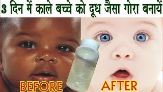 काले बच्चे का रंग दूध जैसा गोरा बनायें Homemade Baby Skin Whitening Lotion [upl. by Ranitta]