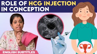 Role Of hCG Injection In Conception  hCG ஊசி செலுத்திய பிறகு கரு முட்டை எப்போது வெளிவரும் [upl. by Aiciram]