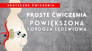 Powiększona Lordoza Lędźwiowa  Ćwiczenia  OTYŁOŚĆ BRZUSZNA [upl. by Noyr]