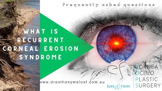 FAQ  What is recurrent corneal erosion syndrome with Dr Anthony Maloof Sydney [upl. by Faun]