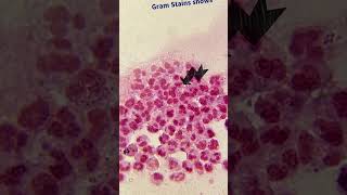 Gram Stain Smear  Neisseria gonorrhoeae  Microbiology science biology microbiology medical [upl. by Lampert]