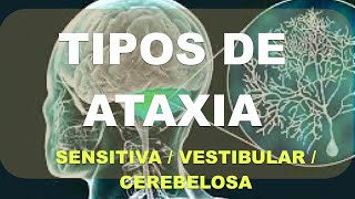 Ataxia Diagnóstico Diferencial Vestibular Sensitivo Cerebeloso [upl. by Stewardson]