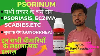 psorinum homeopathic medicine explained in hindi by Dr Ravi Raushan [upl. by Maris]