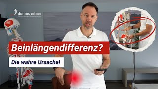 Die wahre Ursache einer Beinlängendifferenz  Was Dir niemand sagt [upl. by Gay]