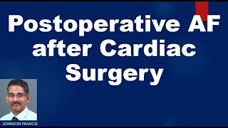 Postoperative AF after Cardiac Surgery [upl. by Suiddaht973]