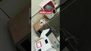 Widal Test viralvideo youtubeshorts medical youtube lab youtube shorts pathology dmltmbbs [upl. by Denten]