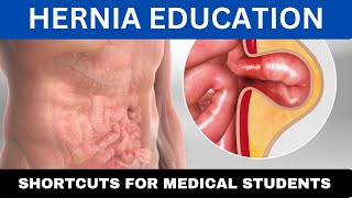 Key Hernia Knowledge Every Med Student Should Master [upl. by Ultann492]