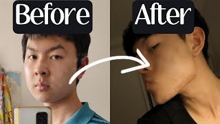 How I Got a STRONG Jawline as a SkinnyFat Guy [upl. by Ahsinrad855]