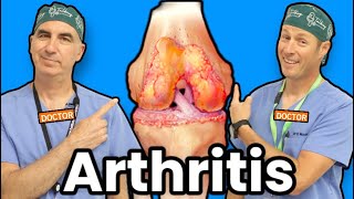 Treating Knee Arthritis Without Surgery [upl. by Nevaed]