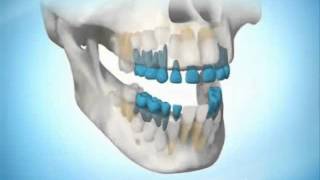 OPCI SALUD CRONOLOGÍA DE LA ERUPCIÓN DENTALwmv [upl. by Eirrej]