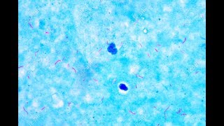 Mycobacterium under microscope afb positive [upl. by Barlow]