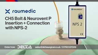 Parenchymal ICP measurement via NPS2 connection to Neurovent P inc CH5 Bolt Insertion  July 2024 [upl. by Phillida450]