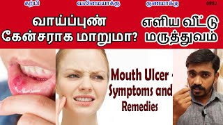 அனைத்து விதமான தீராத வாய்ப்புண் வாய் துற்நாற்றம் முழு தீர்வு l MOUTH ULCER NATURAL REMEDY in TAMIL [upl. by Silvain]