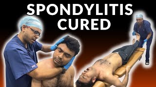 TWISTING Stiffed Neck due to ANKYLOSING SPONDYLITIS  Chiropractic Pain Relief [upl. by Palestine]