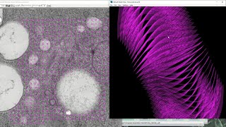 IMOD tutorial  Tomogram generation using Etomo patch tracking [upl. by Issor448]