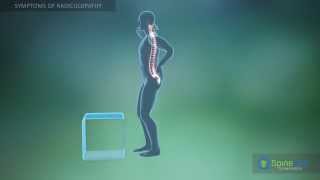 Radiculopathy Symptoms [upl. by Agrippina867]