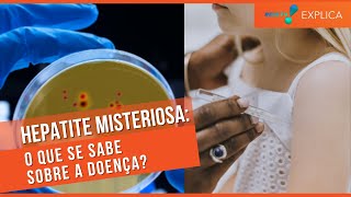 HEPATITE MISTERIOSA O QUE É QUAIS OS SINTOMAS O QUE SE SABE  REDETV EXPLICA 44 [upl. by Liebowitz153]