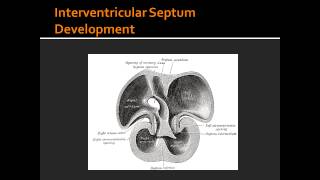 Interventricular Septum Development [upl. by Aciras697]