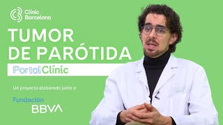 Tumor de Parótida  PortalCLÍNIC [upl. by Ylrehc]