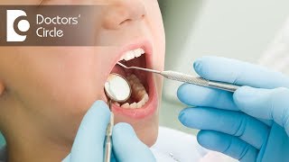 How important is Tooth Fluoride application in children  Dr Sangeeta Honnur [upl. by Aihtibat]