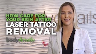 How to Care for Skin After Laser Tattoo Removal  Body Details [upl. by Maharba214]