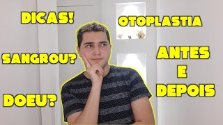 OTOPLASTIA 👂🏻 PÓSOPERATÓRIO RECUPERAÇÃO E MAIS [upl. by Edlitam523]