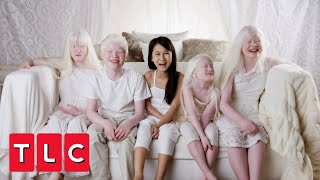 This Couple Adopted Four Children With Albinism  Born with Albinism [upl. by Buehrer7]