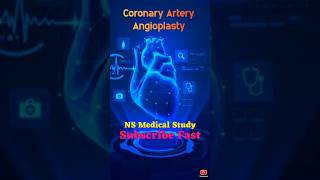 Angiography VS Angioplasty Surgery  Doctor life  viralvideo doctor shorts [upl. by Tevis]