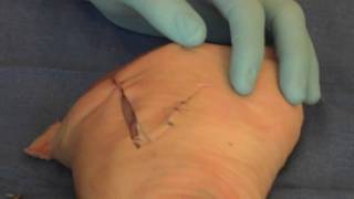 Suture  Dog Ear [upl. by Theodora]