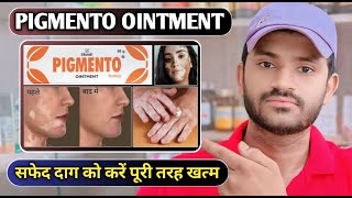 Pigmento ointment use dose benefits and Side effects full review in hindi [upl. by Ball]