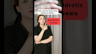 “Dyshidrotic Eczema” shorts doctor skincare viralvideo viralshorts youtubeshorts fyp youtube [upl. by Amik]