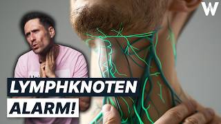 Unbekannte Knubbel Gefährlich von harmlos unterscheiden Wichtigsten Fakten zu großen Lymphknoten [upl. by Ielarol34]