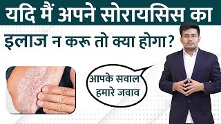 सोरायसिस का इलाज न करने से क्या होता है  Psoriasis Treatment [upl. by Kentiggerma]