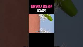 如果被仙人掌扎到手該怎麼辦？漲知識 冷知識 [upl. by Hurff422]