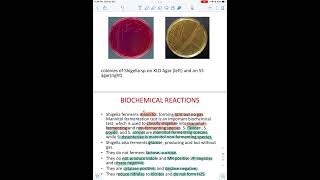 Practical microbiology shigella [upl. by Oralle]