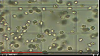 How to count Rbcs amp Wbcs content using Hemocytometer [upl. by Acyssej]