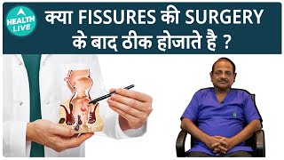 क्या Fissures ठीक हो सकते हैं  Fissures  Health Live [upl. by Attennaj799]