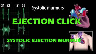 Ejection Click And Systolic Ejection Murmur pf Heart Sound [upl. by Bej]