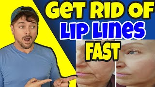 3 THINGS That Get Rid Of LIP LINES And WRINKLES  Chris Gibson [upl. by Haywood]