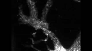 Slime mold formation [upl. by Crawford]