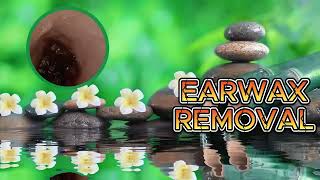 P17 Manual Removal The Ear Wax Removal Satisfying earwax cleaning with relaxing time [upl. by Doggett]