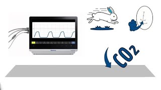 MedEd capnography byte 14 Tachypnea with hypocarbia [upl. by Enitsrik]