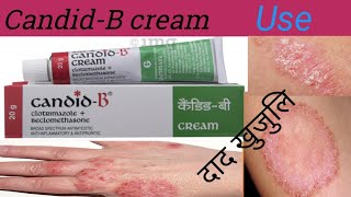 candid b cream usecandid b cream use in nepalicandid b cream use for fungal infectionदाद को मलम [upl. by Alodee]