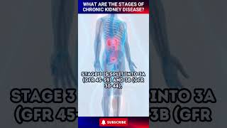 What are the Stages of Chronic Kidney Disease shorts [upl. by Edualc903]