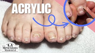 Big Toenail Repair Pedicure Tutorial at Home [upl. by Ysnat991]