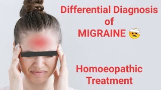 Migraine  Severe Headache  Homeopathic Treatment  Homeopathic Medicine  माइग्रेन [upl. by Boswell]